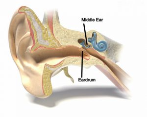 barotrauma ear icd 10